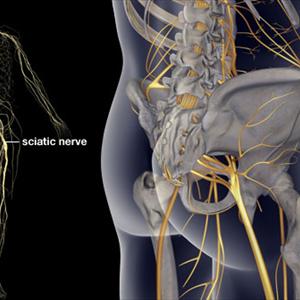 Treating Sciatic Pain - Pinched Nerve Pain Causes And Relief With The Drx9000 Spinal Decompression System