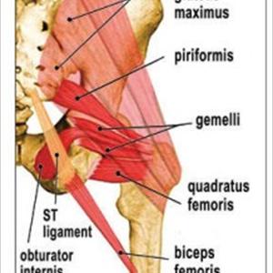 Homeopathic Sciatic Relief - All About Sciatica